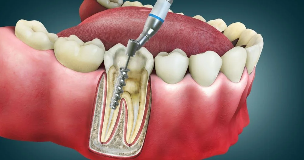 Best dentist in Kanpur