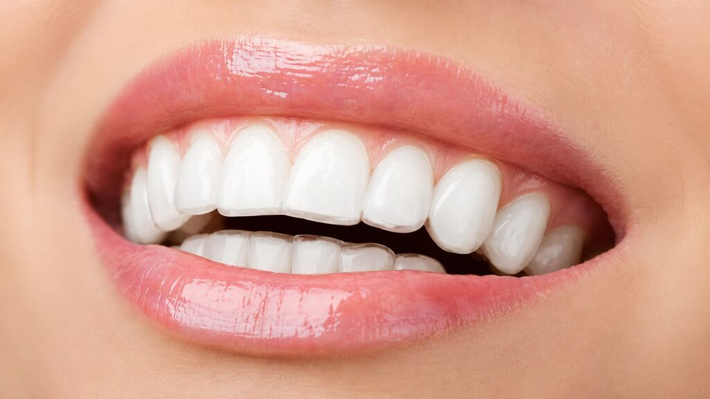 Best Teeth Aligners Clinic in Kanpur